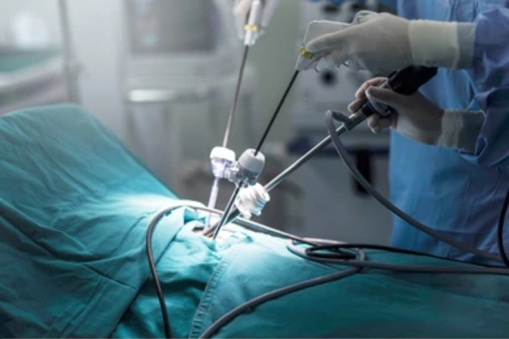 Diagnostic Laparoscopy--------12