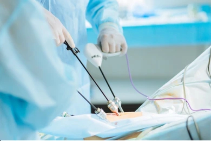Laparoscopic Hysterectomy--------12